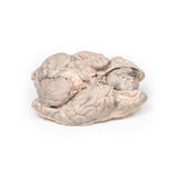 Meningioma | EZ-MP2004 | Sim & Skills Ltd