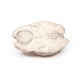 Meningioma | EZ-MP2004 | Sim & Skills Ltd