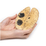 Cerebral Haemorrhage, secondary to Acute Myeloid Leukaemia | EZ-MP2009 | Sim & Skills Ltd