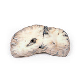 Cerebral Arterio-Venous Malformation | EZ-MP2010 | Sim & Skills Ltd
