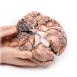 Ruptured Berry Aneurysm | EZ-MP2013 | Sim & Skills Ltd