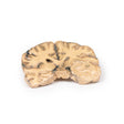 Astrocytoma | EZ-MP2014 | Sim & Skills Ltd