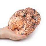 Metastatic melanoma | EZ-MP2018 | Sim & Skills Ltd