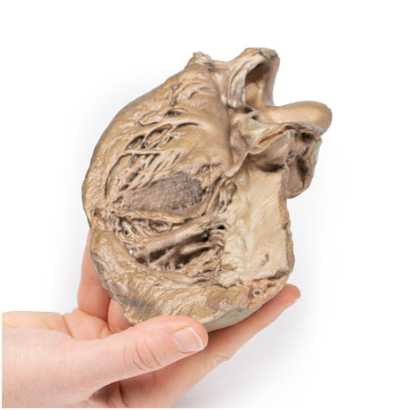 Bicuspid Aortic Valve | EZ-MP2033 | Sim & Skills Ltd
