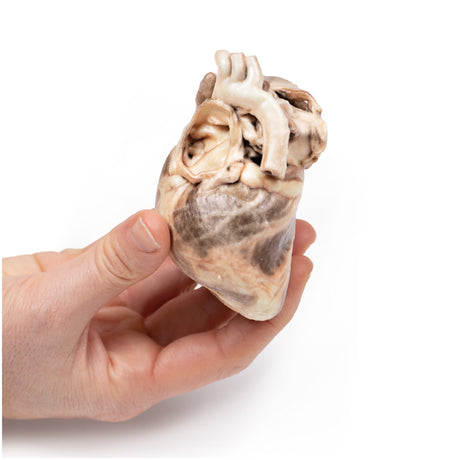 Congenital Pulmonary Stenosis | EZ-MP2034 | Sim & Skills Ltd