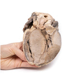 Hypertrophic Subaortic stenosis | EZ-MP2036 | Sim & Skills Ltd