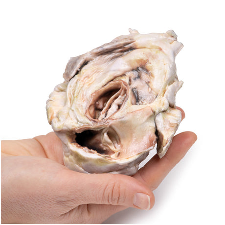 Calcified Aortic Valvular Stenosis Bicuspid Aortic Valve | EZ-MP2038 | Sim & Skills Ltd