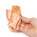 Traumatic Oesophageal-aortic fistula | EZ-MP2040 | Sim & Skills Ltd
