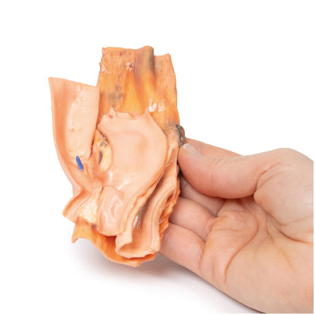 Traumatic Oesophageal-aortic fistula | EZ-MP2040 | Sim & Skills Ltd