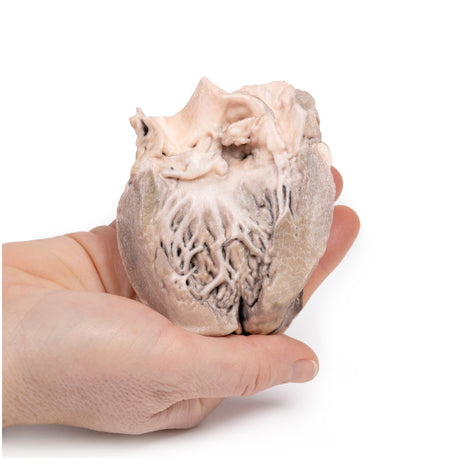 Acute Bacterial Endocarditis | EZ-MP2041 | Sim & Skills Ltd