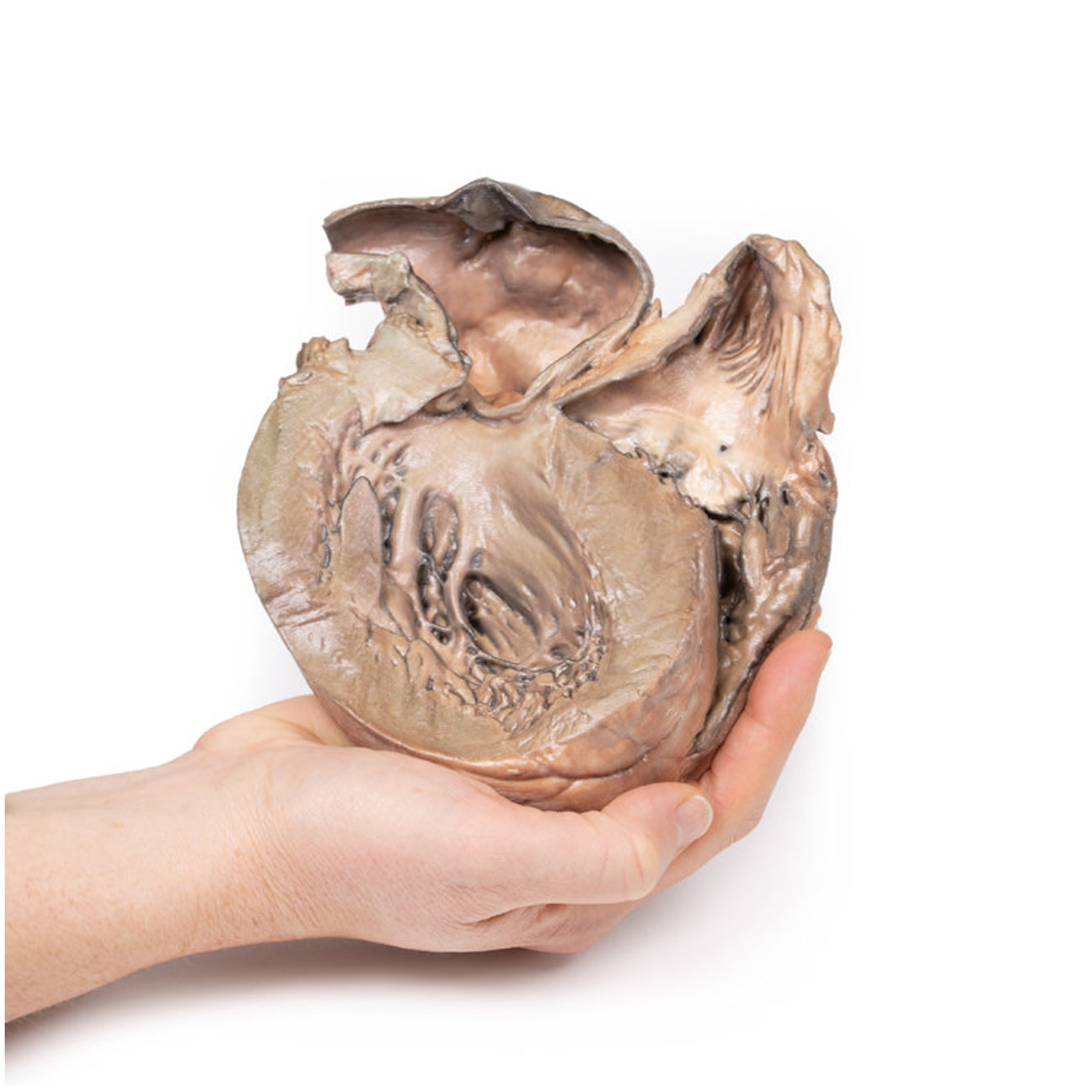 Ruptured Thoracic Aortic Aneurysm | EZ-MP2043 | Sim & Skills Ltd