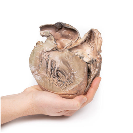 Ruptured Thoracic Aortic Aneurysm | EZ-MP2043 | Sim & Skills Ltd