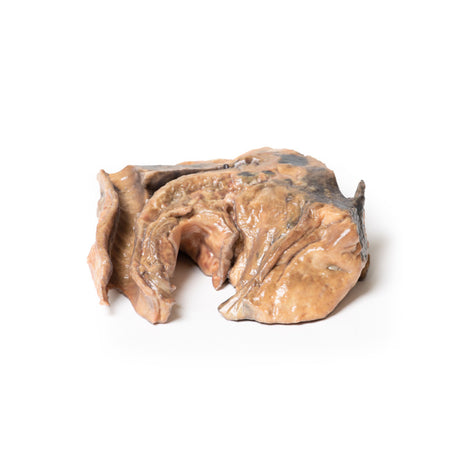 Inhaled Foreign Body—trachea | EZ-MP2053 | Sim & Skills Ltd