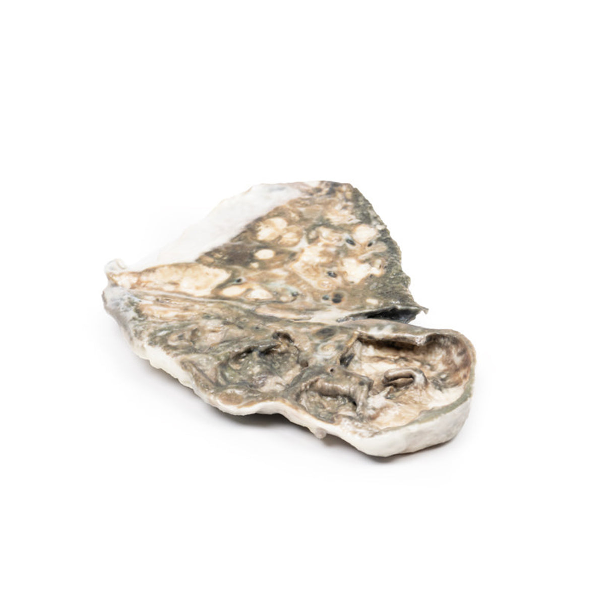 Fibrocaseous Tuberculosis | EZ-MP2054 | Sim & Skills Ltd
