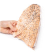 Right lung miliary tuberculosis | EZ-MP2060 | Sim & Skills Ltd