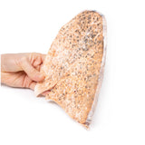 Right lung miliary tuberculosis | EZ-MP2060 | Sim & Skills Ltd