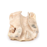 Trachea—Hodgkin Lymphoma | EZ-MP2062 | Sim & Skills Ltd