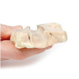 Trachea—Hodgkin Lymphoma | EZ-MP2062 | Sim & Skills Ltd