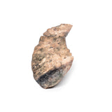 Lung—Cystic Fibrosis | EZ-MP2063 | Sim & Skills Ltd
