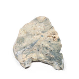 Lung - Staphylococcus aureus Abscesses | EZ-MP2064 | Sim & Skills Ltd