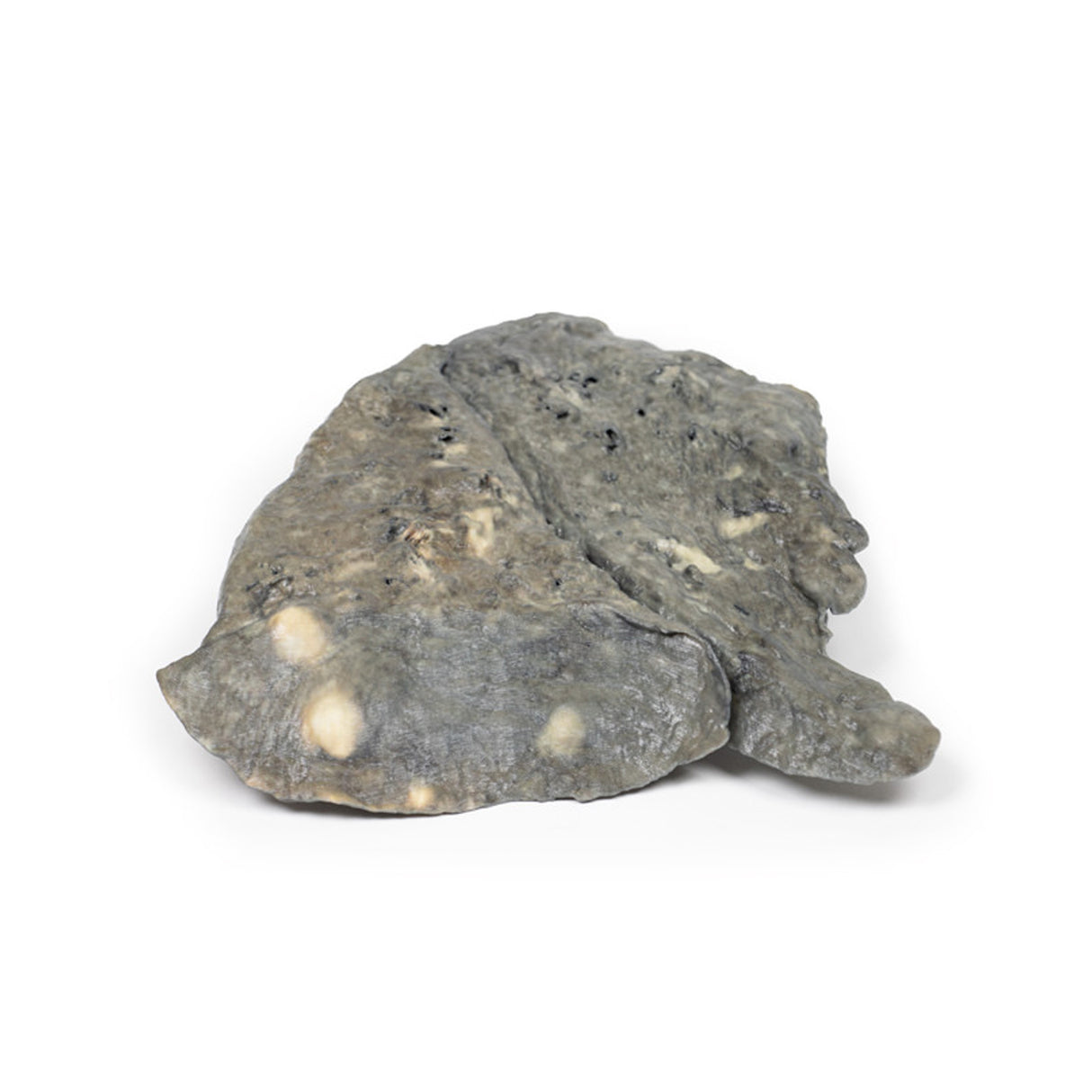 Lung—Multiple Secondary Carcinoma Deposits in The Lung and Pleura | EZ-MP2065 | Sim & Skills Ltd