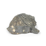 Lung—Multiple Secondary Carcinoma Deposits in The Lung and Pleura | EZ-MP2065 | Sim & Skills Ltd