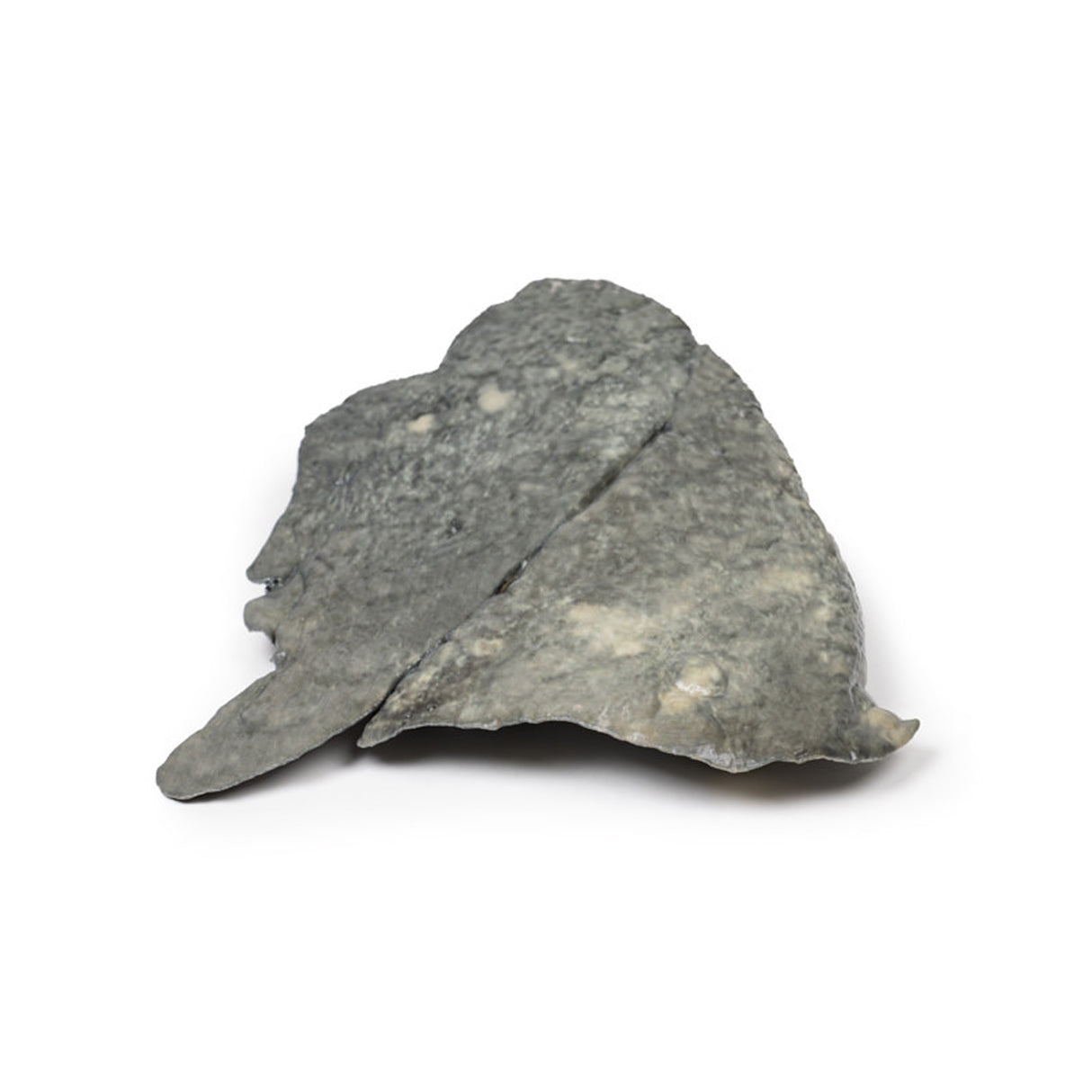 Lung—Multiple Secondary Carcinoma Deposits in The Lung and Pleura | EZ-MP2065 | Sim & Skills Ltd