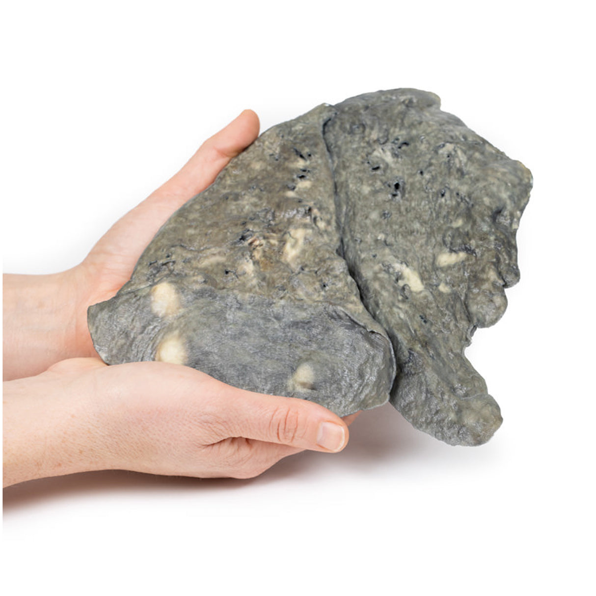 Lung—Multiple Secondary Carcinoma Deposits in The Lung and Pleura | EZ-MP2065 | Sim & Skills Ltd