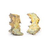 Multiple Polyposis Coli | EZ-MP2070 | Sim & Skills Ltd