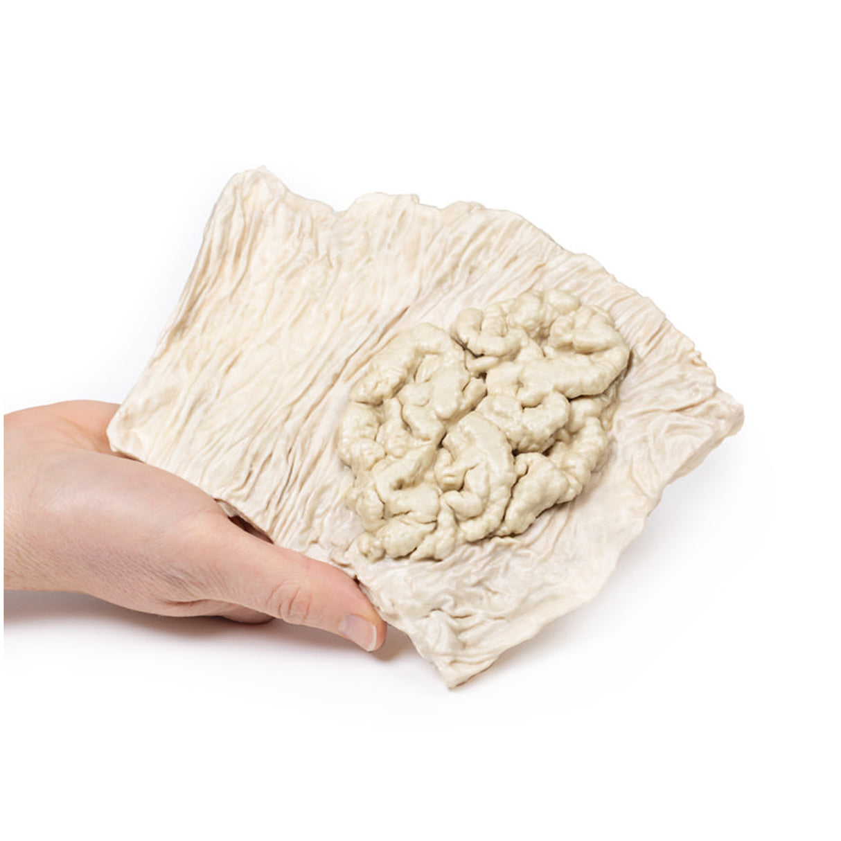 Villous adenoma of colon | EZ-MP2071 | Sim & Skills Ltd