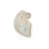 Fatty Liver | EZ-MP2072 | Sim & Skills Ltd
