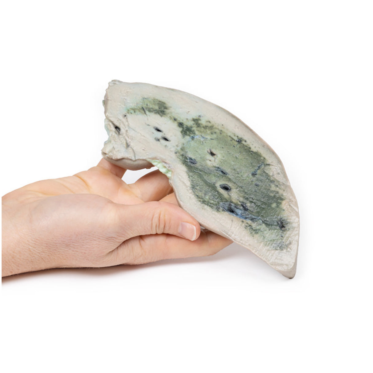 Fatty Liver | EZ-MP2072 | Sim & Skills Ltd