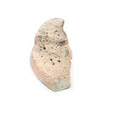 Liver cirrhosis | EZ-MP2073 | Sim & Skills Ltd