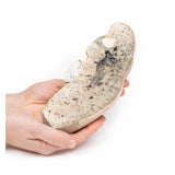 Liver cirrhosis | EZ-MP2073 | Sim & Skills Ltd