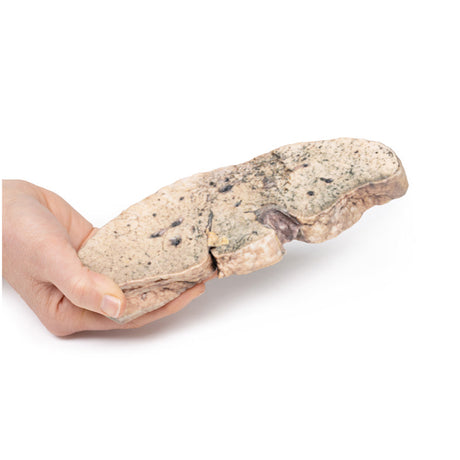 Liver cirrhosis | EZ-MP2073 | Sim & Skills Ltd