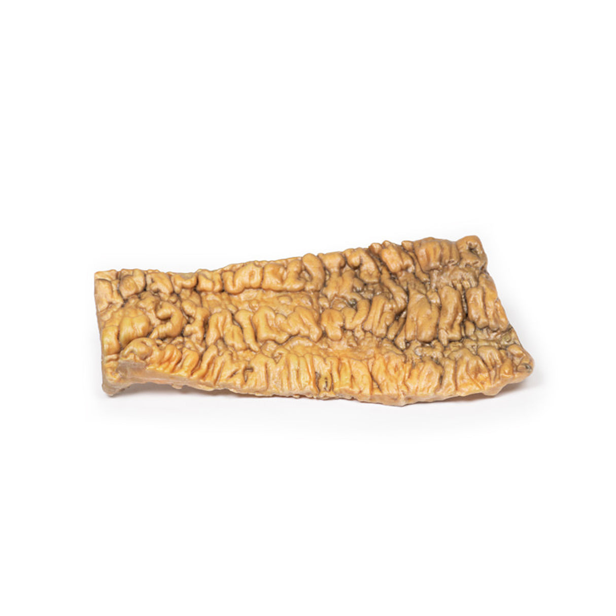 Ulcerative Colitis | EZ-MP2074 | Sim & Skills Ltd