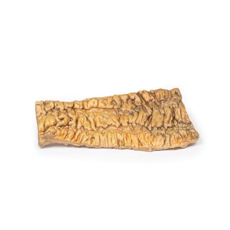 Ulcerative Colitis | EZ-MP2074 | Sim & Skills Ltd