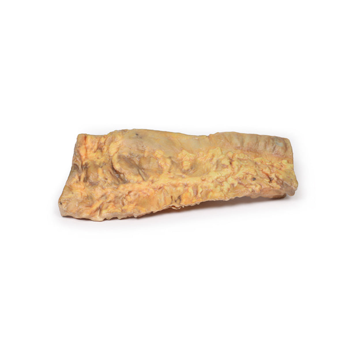 Ulcerative Colitis | EZ-MP2074 | Sim & Skills Ltd