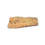 Ulcerative Colitis | EZ-MP2074 | Sim & Skills Ltd