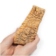 Ulcerative Colitis | EZ-MP2074 | Sim & Skills Ltd