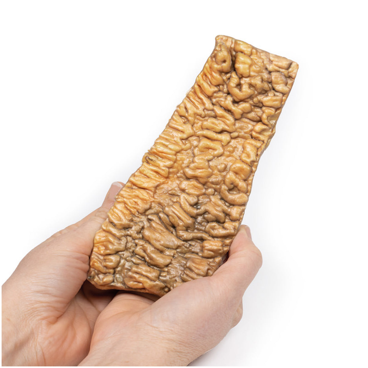 Ulcerative Colitis | EZ-MP2074 | Sim & Skills Ltd