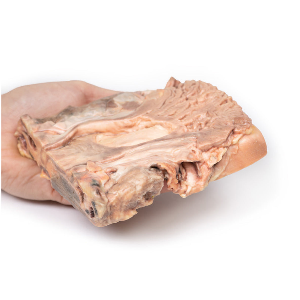 Chronic Gastric Ulcer | EZ-MP2076 | Sim & Skills Ltd