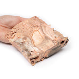 Chronic Gastric Ulcer | EZ-MP2076 | Sim & Skills Ltd