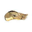 Intussusception of small bowel due to metastatic tumour | EZ-MP2077 | Sim & Skills Ltd