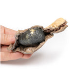 Gallstone Ileus | EZ-MP2078 | Sim & Skills Ltd