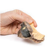 Gallstone Ileus | EZ-MP2078 | Sim & Skills Ltd