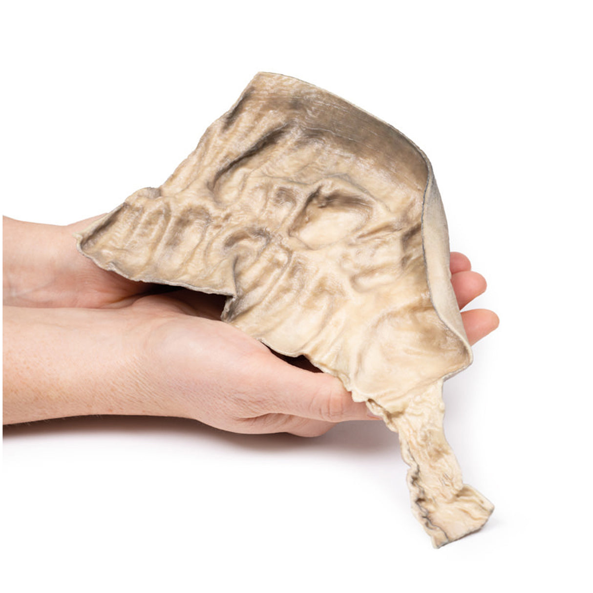 Hirschsprung's Disease | EZ-MP2079 | Sim & Skills Ltd