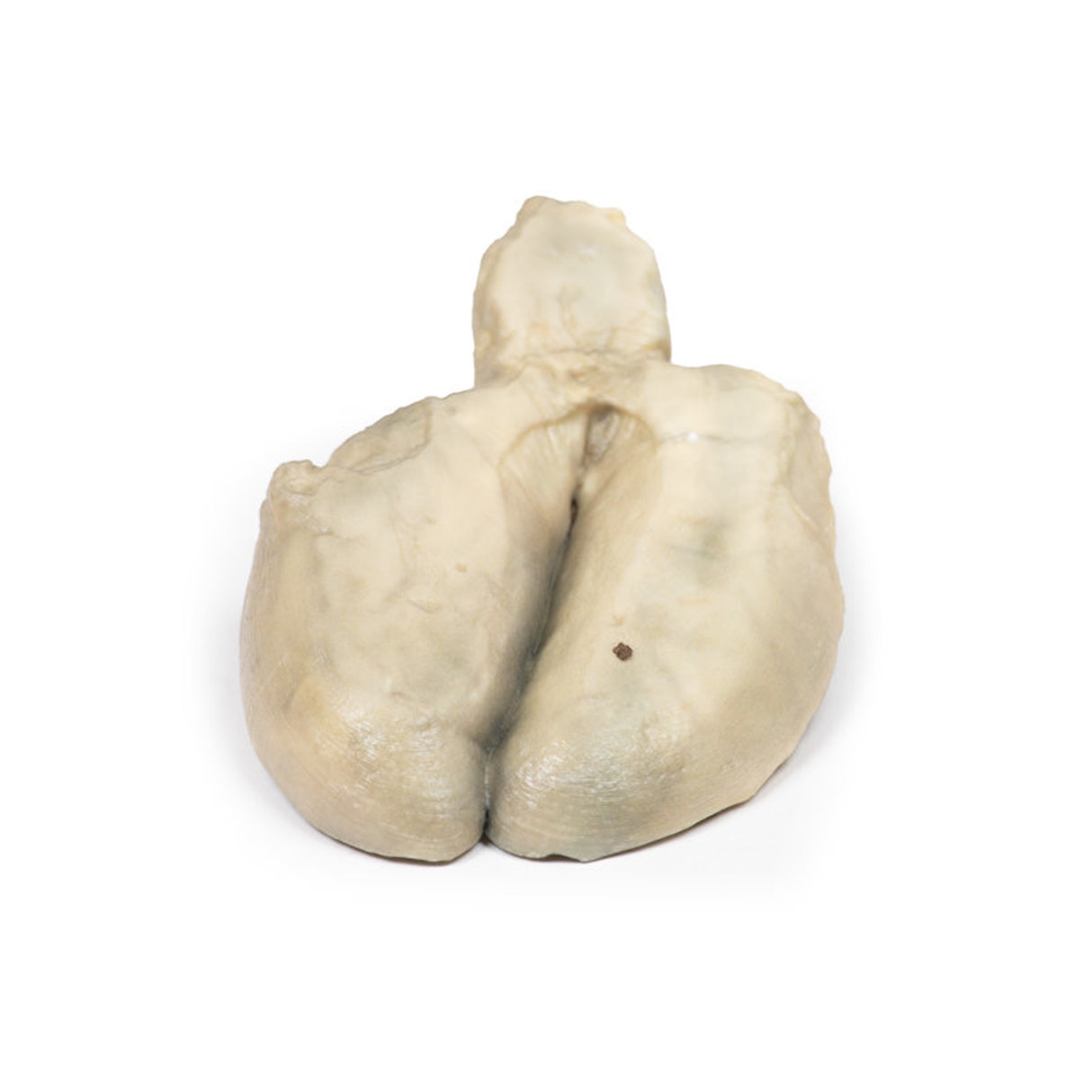 Cholecystitis and Cholelithiasis | EZ-MP2082 | Sim & Skills Ltd
