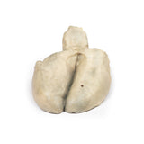 Cholecystitis and Cholelithiasis | EZ-MP2082 | Sim & Skills Ltd