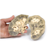 Horseshoe Kidney | EZ-MP2092 | Sim & Skills Ltd